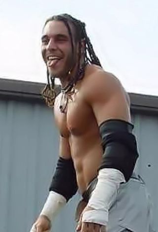 image of Trent Acid